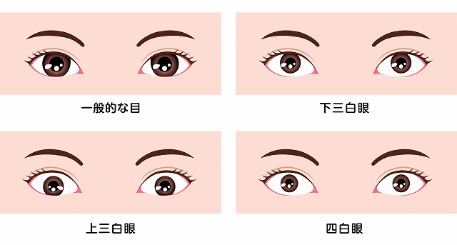 片目 充血 目 の 原因 目の充血と一緒にかゆみが伴う時の原因・病気は？