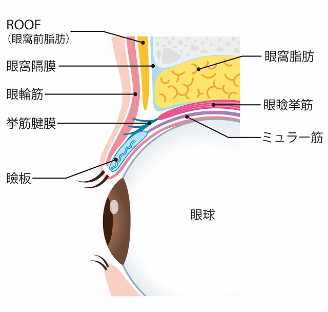 眼瞼下垂の手術方法